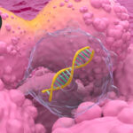 treatment intensification slows metastatic hormone sensitive prostate cancer