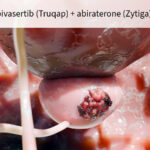 fda approves prostate cancer combo that warranted advisory meeting