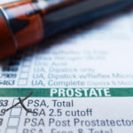 multicomponent test tops psa for clinically significant prostate cancers