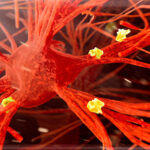 alzheimer's biomarkers change after tuberculosis vaccination