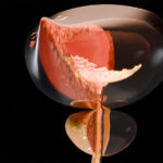 many men with luts could be candidates to stop alpha blocker treatment